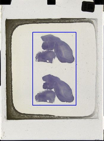 Media type: image; Special Collections 3043   shows specimen_part histological serial section;